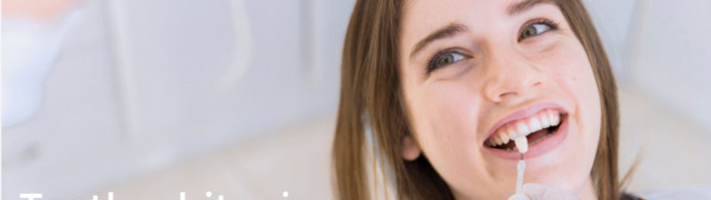 Teeth Whitening: Everything you need to know