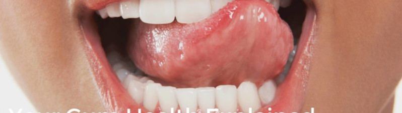 Periodontitis, Gum Disease and How to Treat it