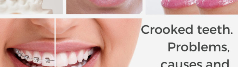 Crooked Teeth Causes, Problems and How to Fix Them