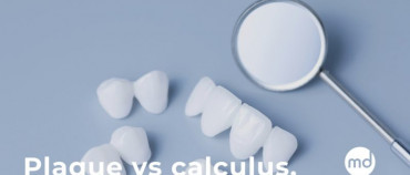 The Difference Between Plaque And Calculus