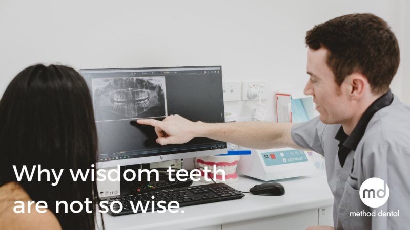 All You Ever Wanted To Know About Wisdom Teeth