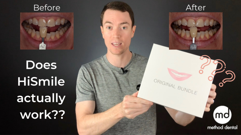 HiSmile Review: Does it actually work?  Is it worth your money?