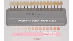 Red teeth in HiSmile's shade guide