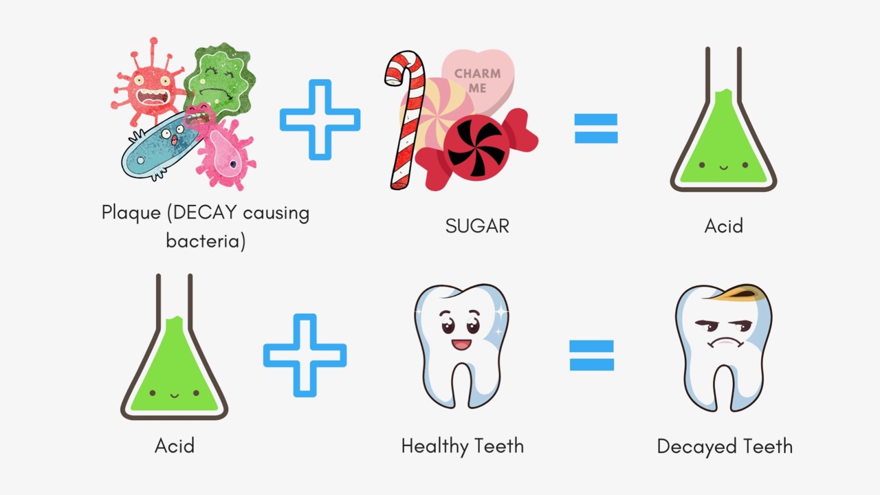 tooth decay causing germs eat sugar, then produce acid and the acid dissolves tooth enamel