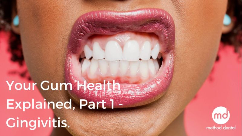 Bleeding gums, gingivitis and how to fix it