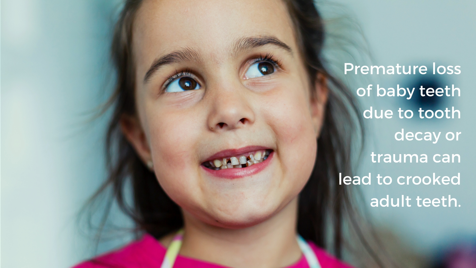 Young girl with tooth decay in baby teeth