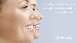 A woman wearing Invisalign clear aligners to treat crooked teeth