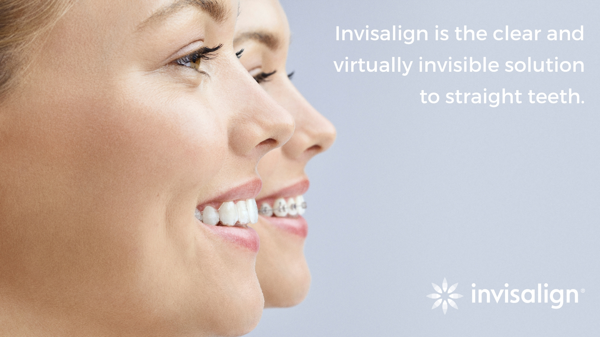 A woman wearing Invisalign clear aligners to treat crooked teeth