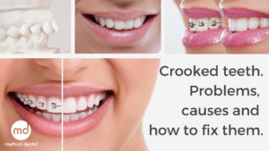 Crooked teeth shown in a few images showing potential problems