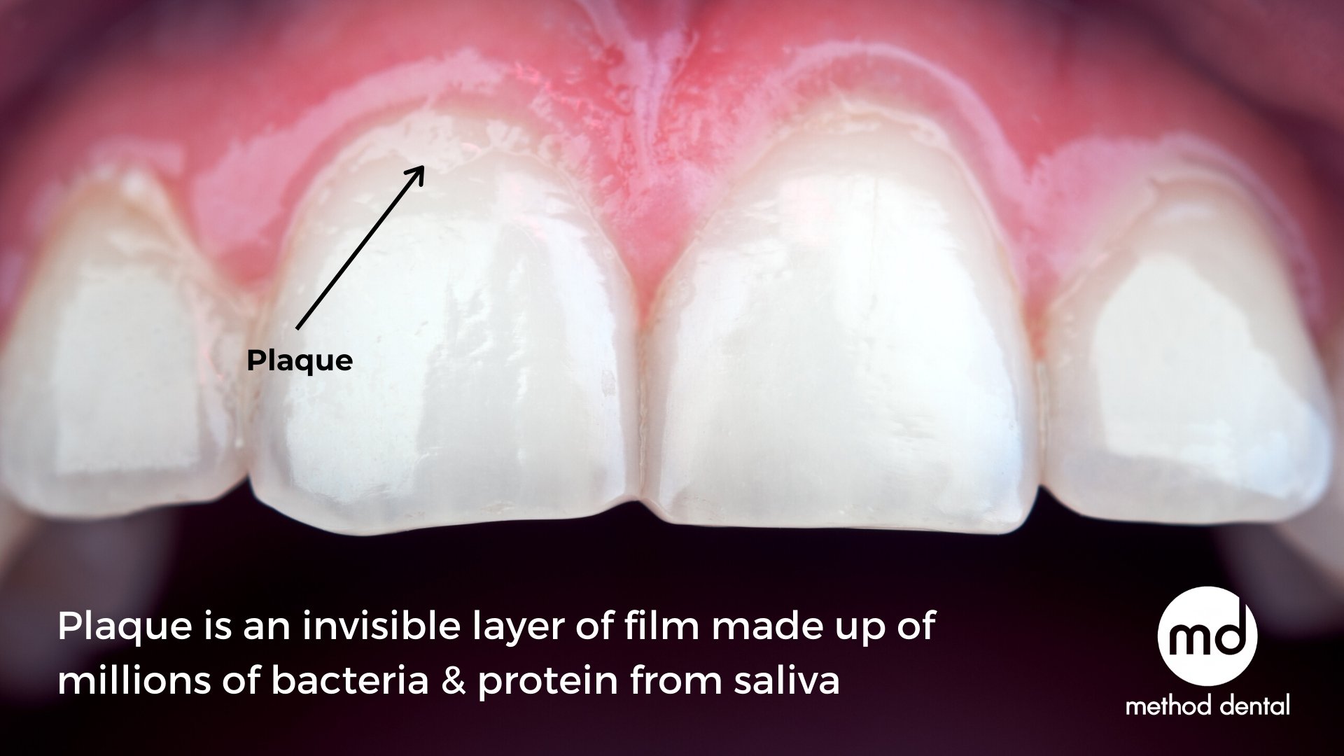 How to keep our teeth white